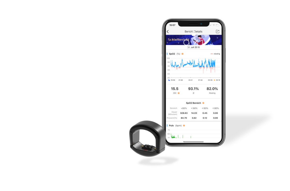 Der CIRCUL Fitness Tracker Ring vor einem Smartphone mit einem geöffneten Schlafbericht auf dem Bildschirm